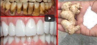 VIDEO – Amestecul care iti albeste dintii intr-un timp foarte scurt – Cum se prepara